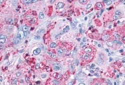 Mas Antibody, Novus Biologicals 50 &mu;g; Unconjugated:Antibodies, Polyclonal